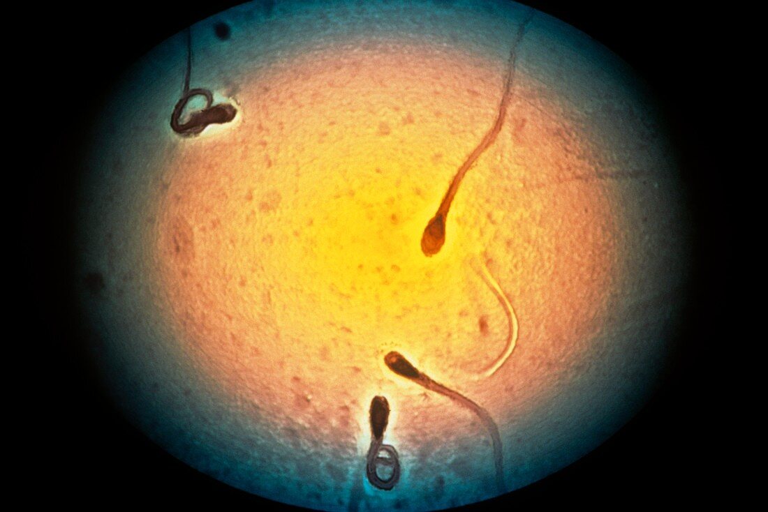 Normal and atypical sperm