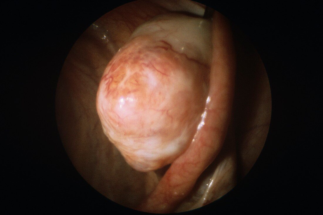 Corpus luteum in ovarian cycle