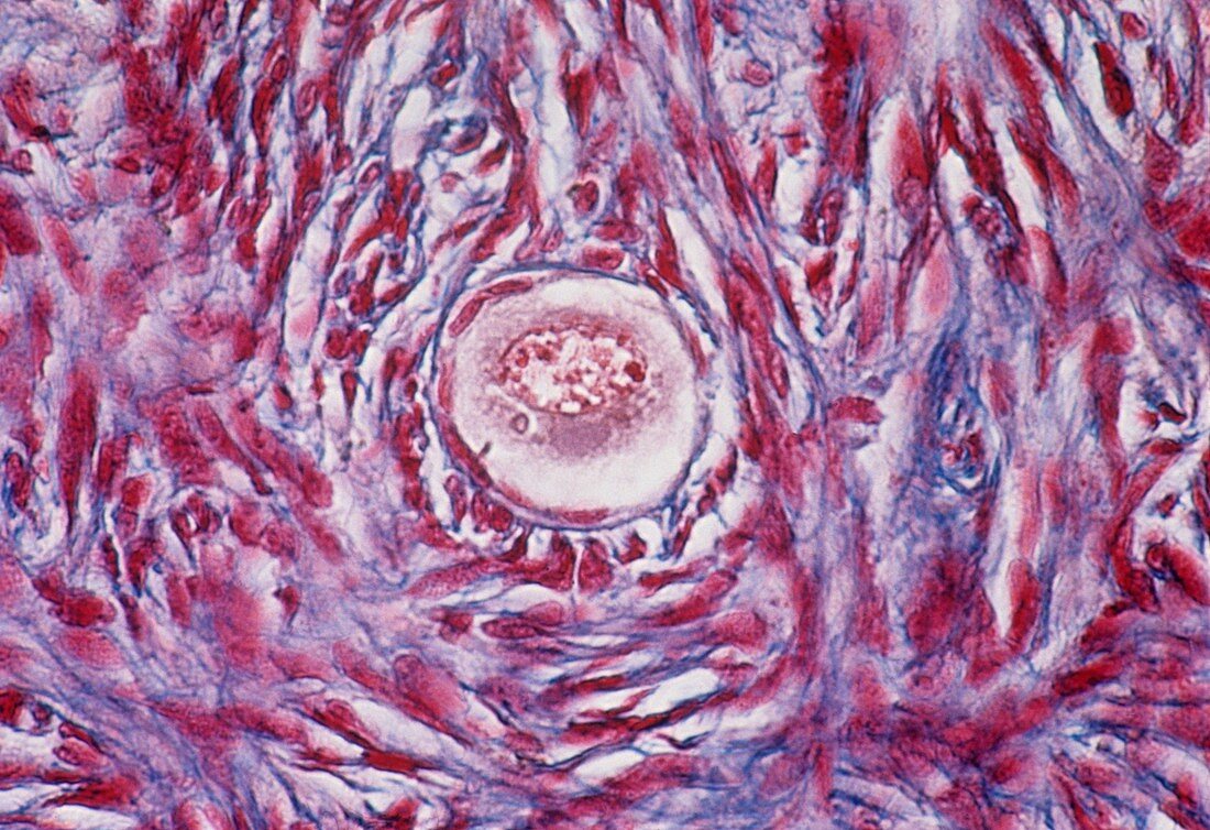 Primordial egg follicle in an ovary