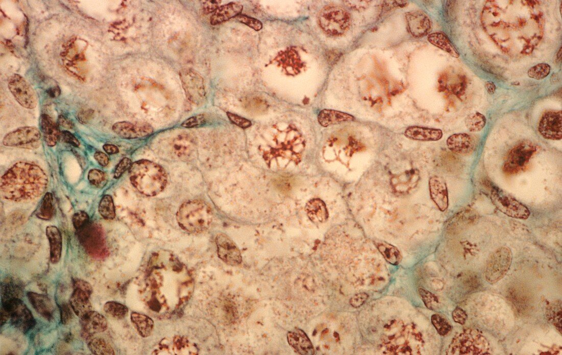Foetal ovarian tissue,light micrograph