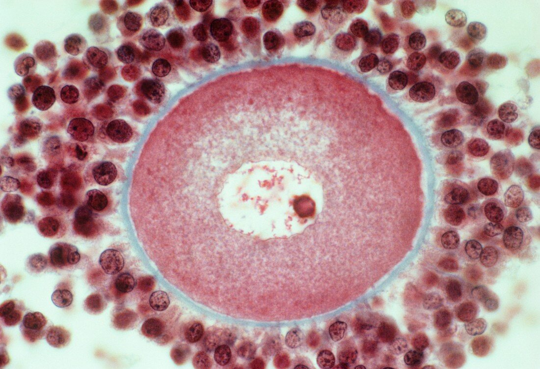 Prometaphase oocyte,light micrograph