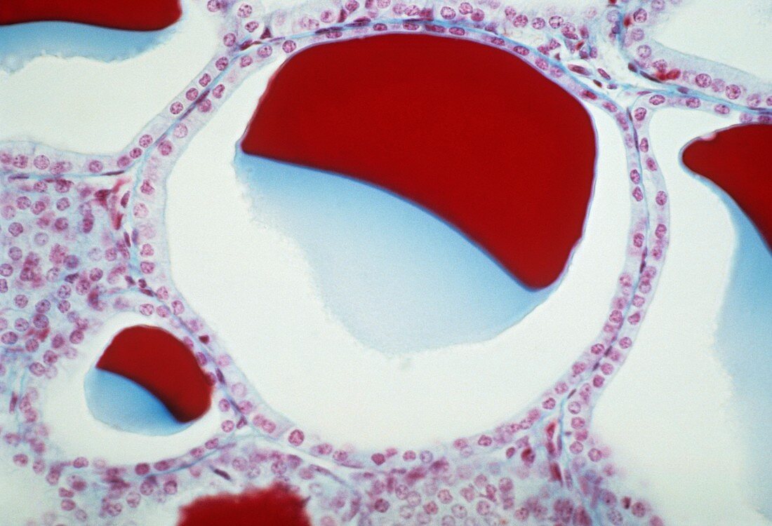 Thyroid follicles,light micrograph