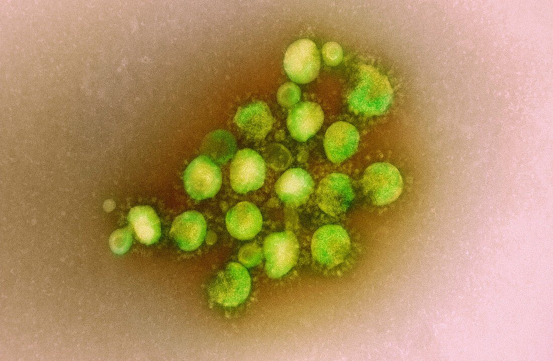 MERS coronavirus,TEM