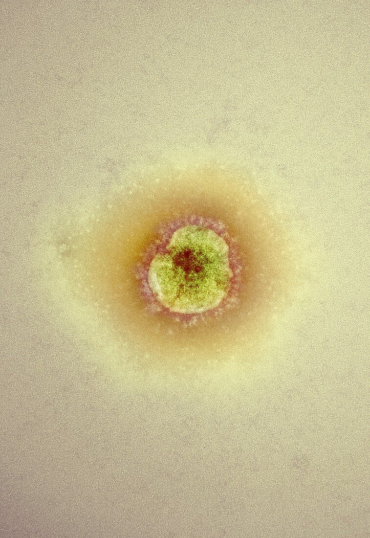 MERS coronavirus,TEM