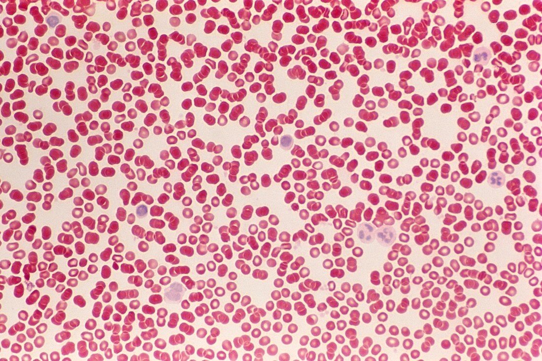 Blood cells,light micrograph