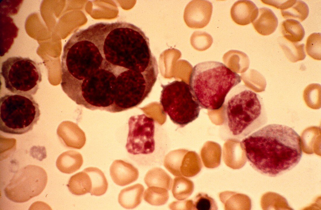Erythroblast blood cell,light micrograph