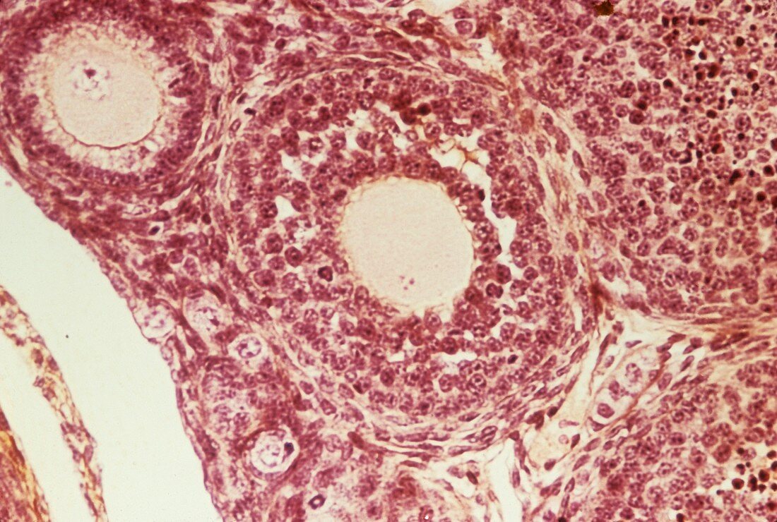 Ovarian follicles,light micrograph