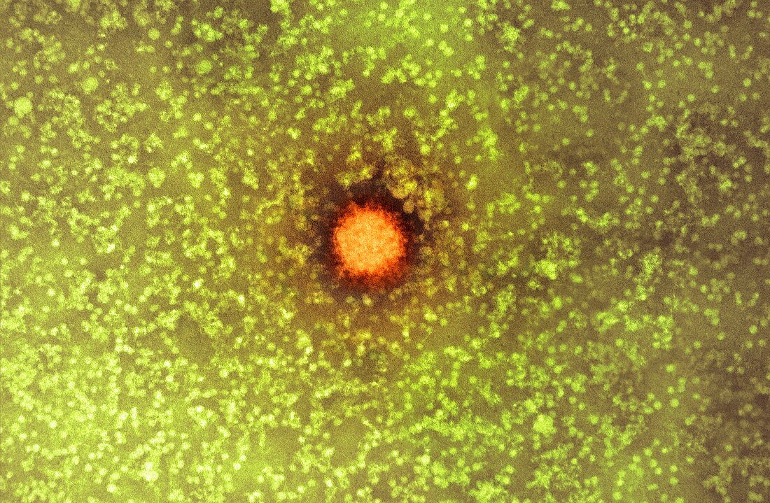 Schmallenberg virus,TEM