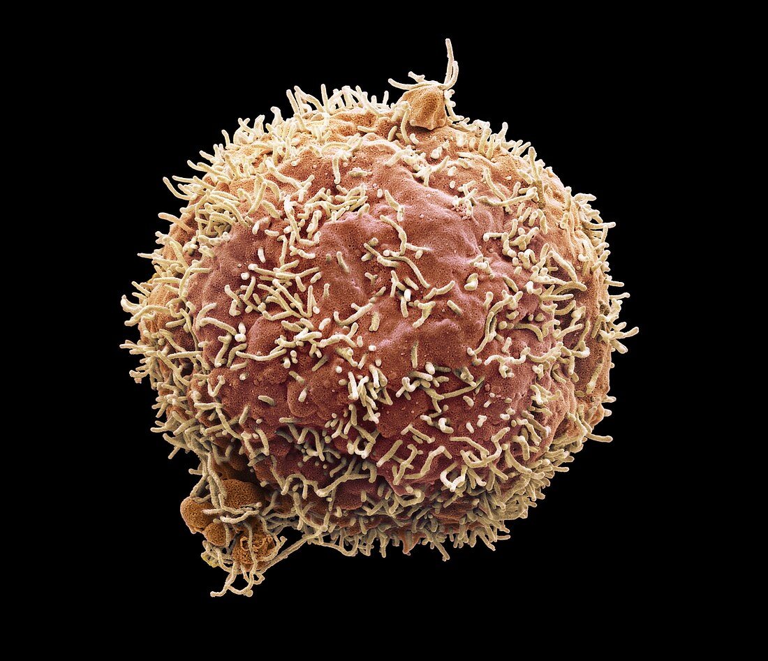 Liver cancer cell,SEM