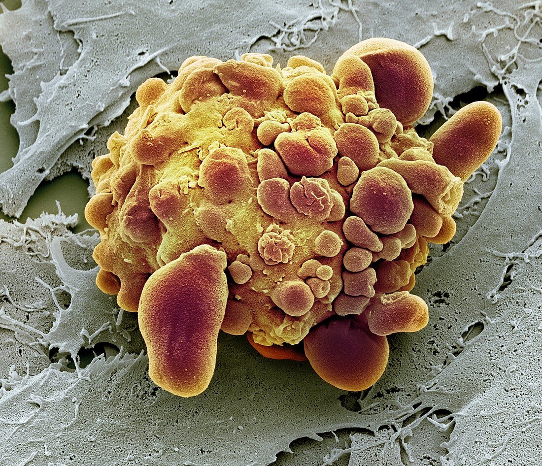 Stem cell dying,SEM