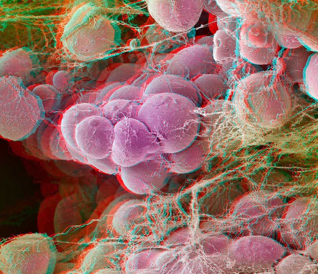 Fat tissue,stereoscopic SEM