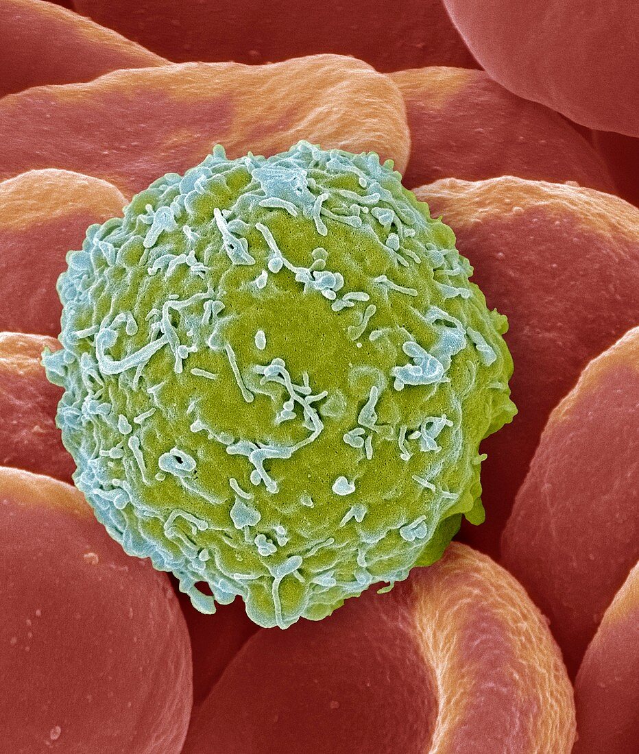 Leukaemia cell,SEM