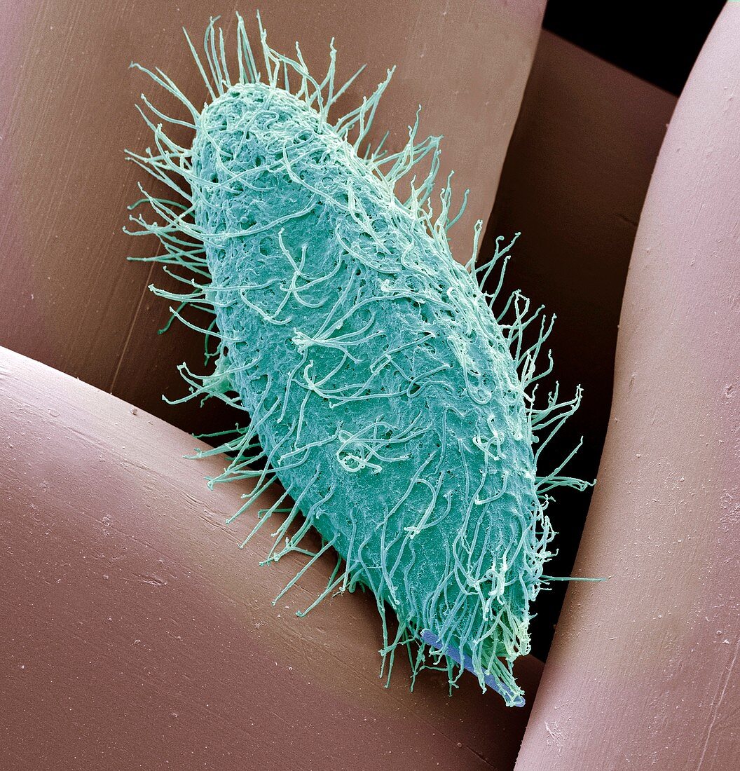 Ciliate protozoan,SEM