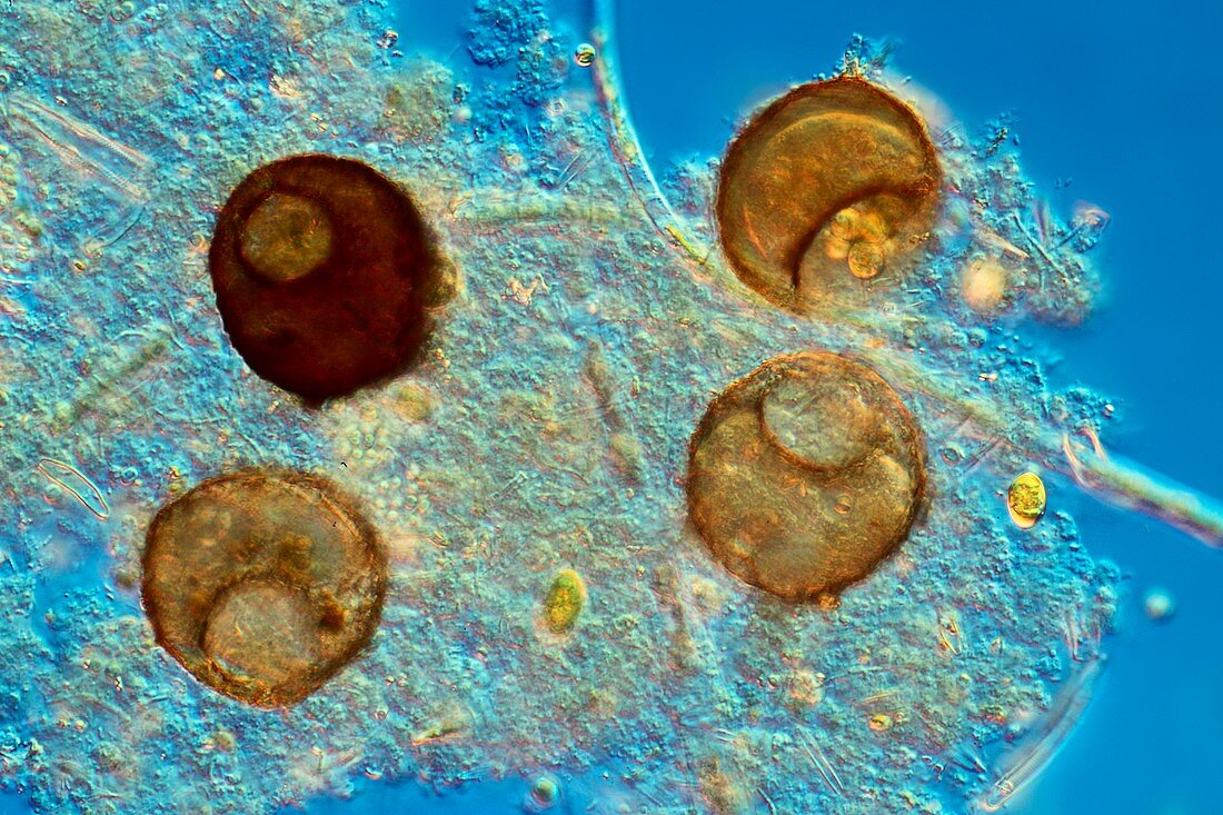 Amoeboid protozoa,SEM