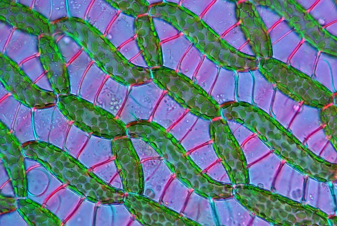 Sphagnum moss cells,light micrograph