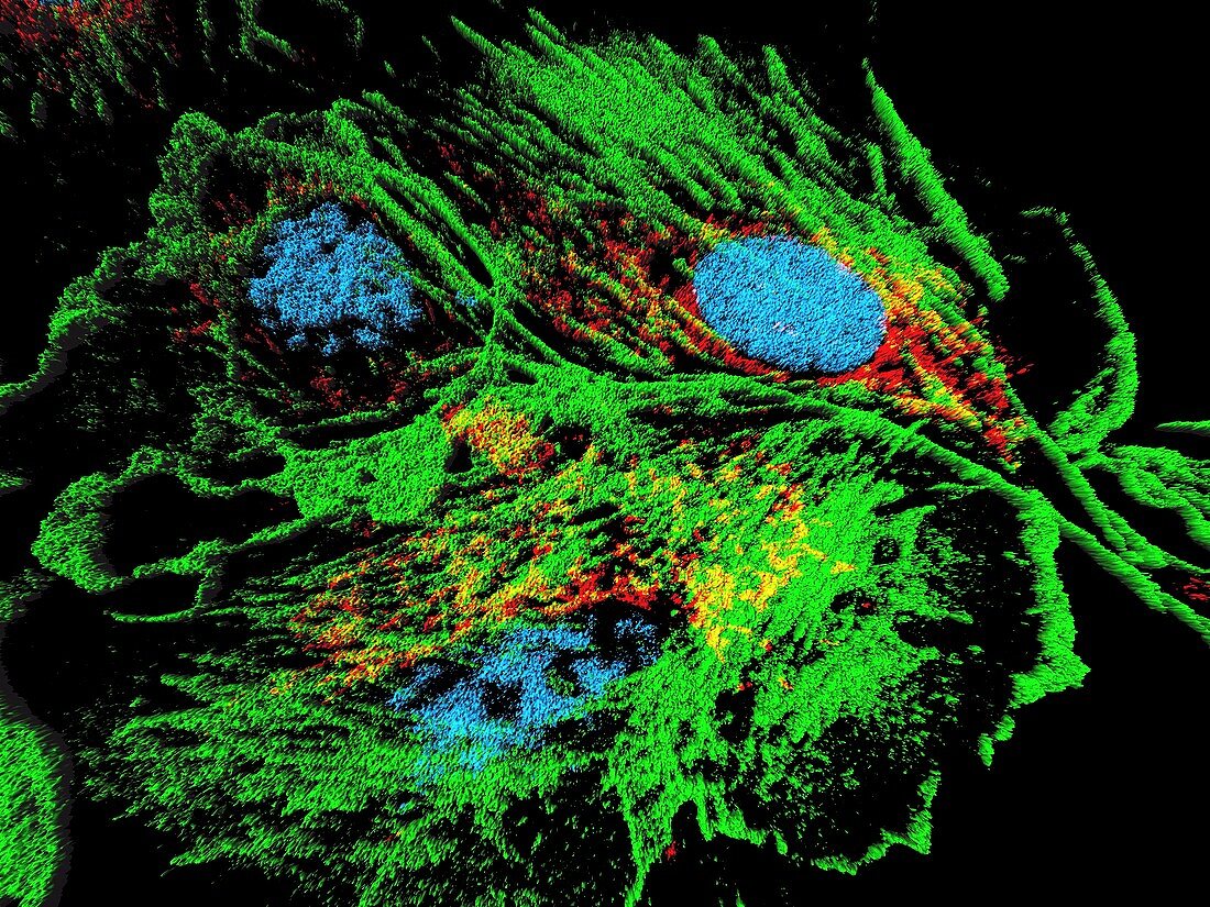 Lung cells,fluorescent micrograph