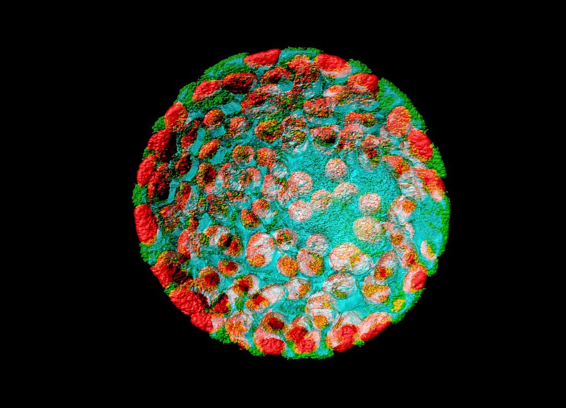 Plant protoplast,fluorescent micrograph