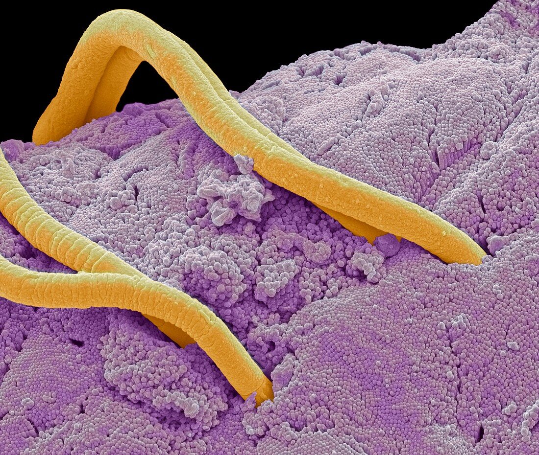 Threadworms in the gut,SEM