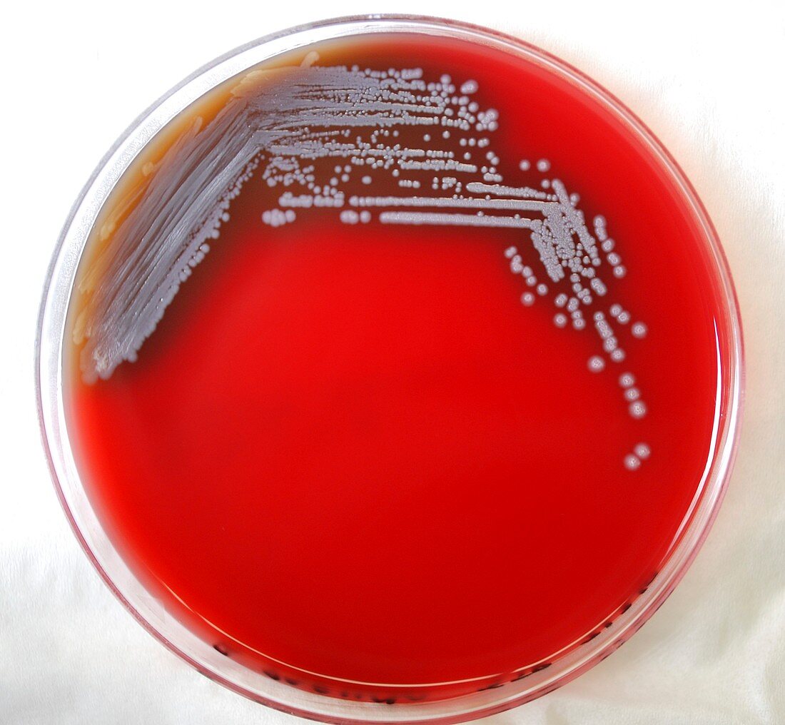 Burkholderia pseudomallei bacteria
