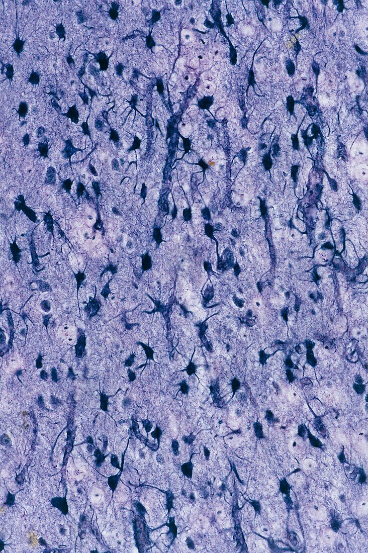 Brain glial cells,light micrograph
