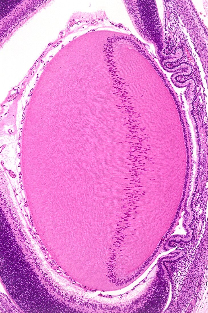 Foetal lens development,light micrograph