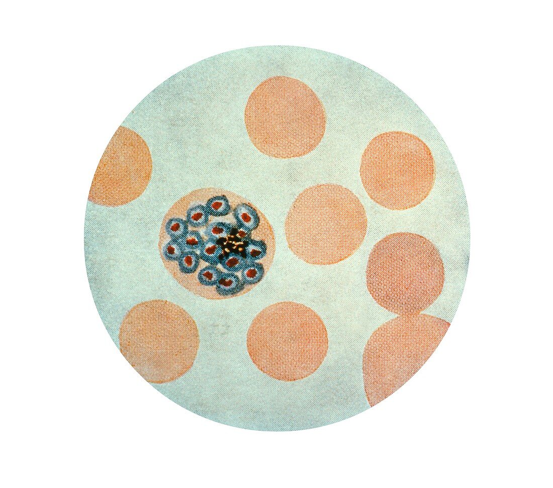 Malaria parasite in red blood cell