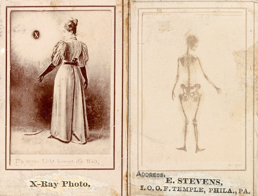 Early X-ray demonstration,1896