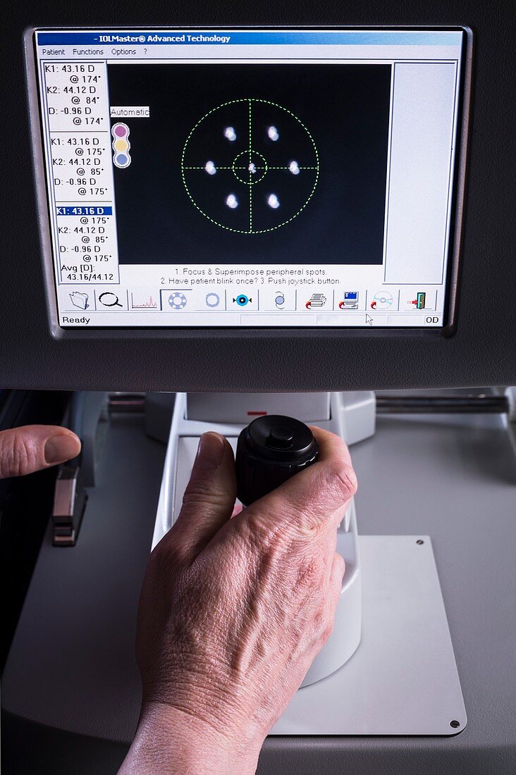 Cataract surgery eye biometry test