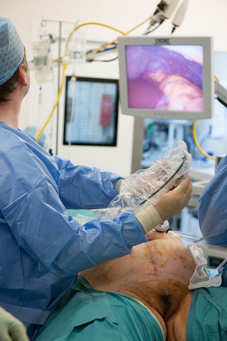 Ovarian cancer surgery