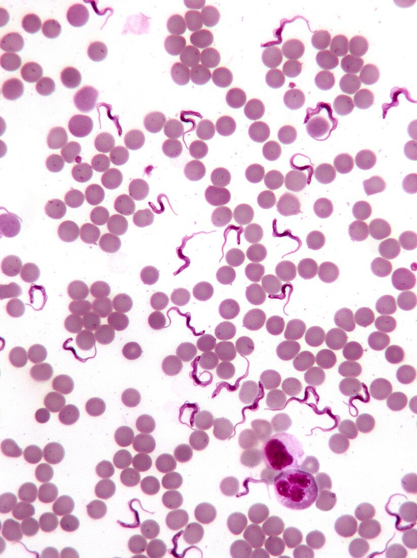 Trypanosomes in blood smear,SEM