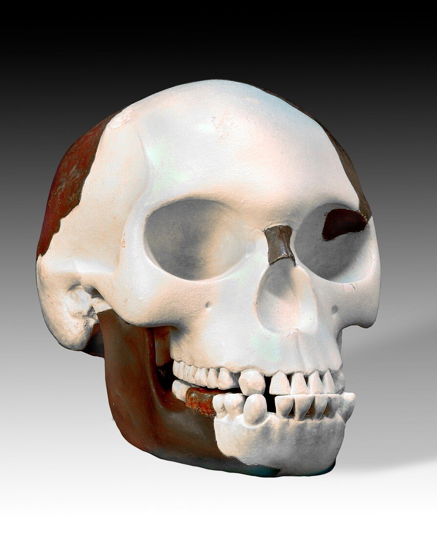 Reconstruction of Piltdown skull