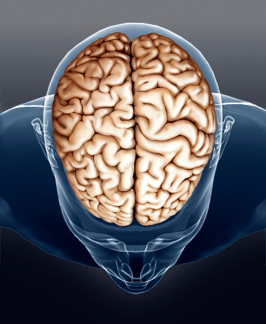 Human brain,MRI scan