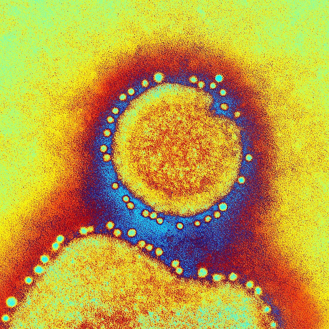 Avian influenza virus H7N9,TEM
