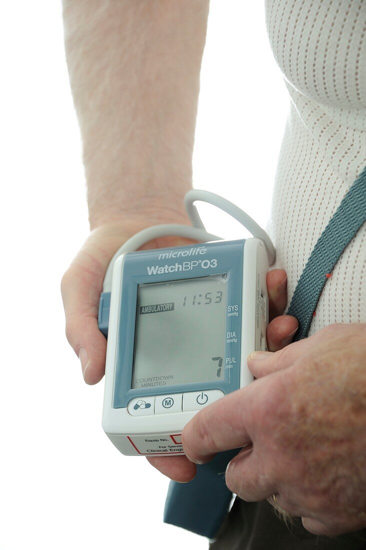 24 hour blood pressure monitoring