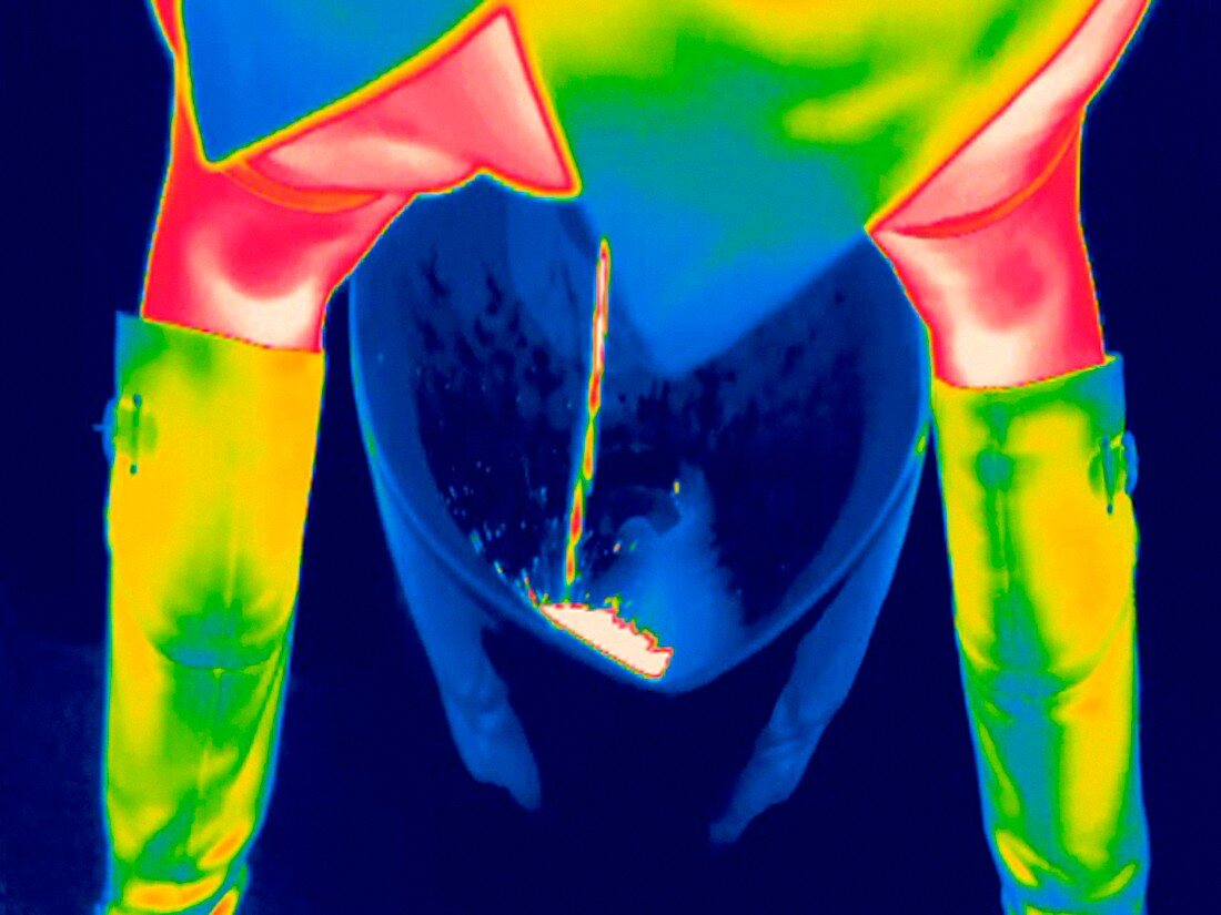 Woman using a urinal,thermogram