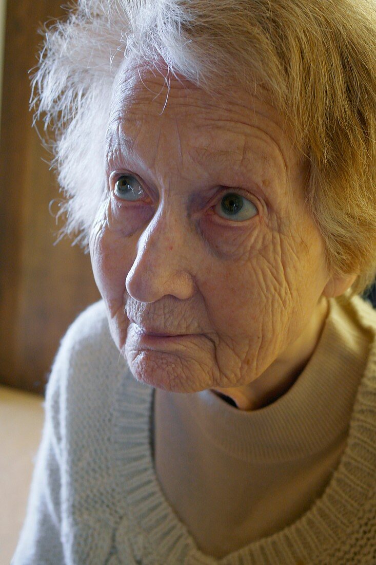Woman with Alzheimer's disease