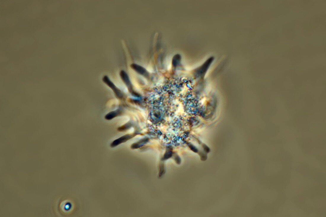 Amoeba protozoan,light micrograph