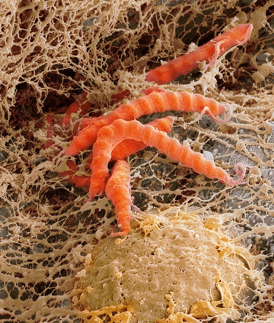 Helicobacter pylori bacteria,SEM