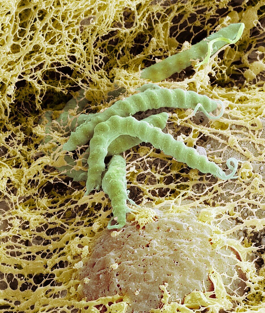 Helicobacter pylori bacteria,SEM