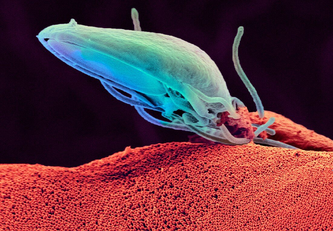 Giardia protozoan,SEM