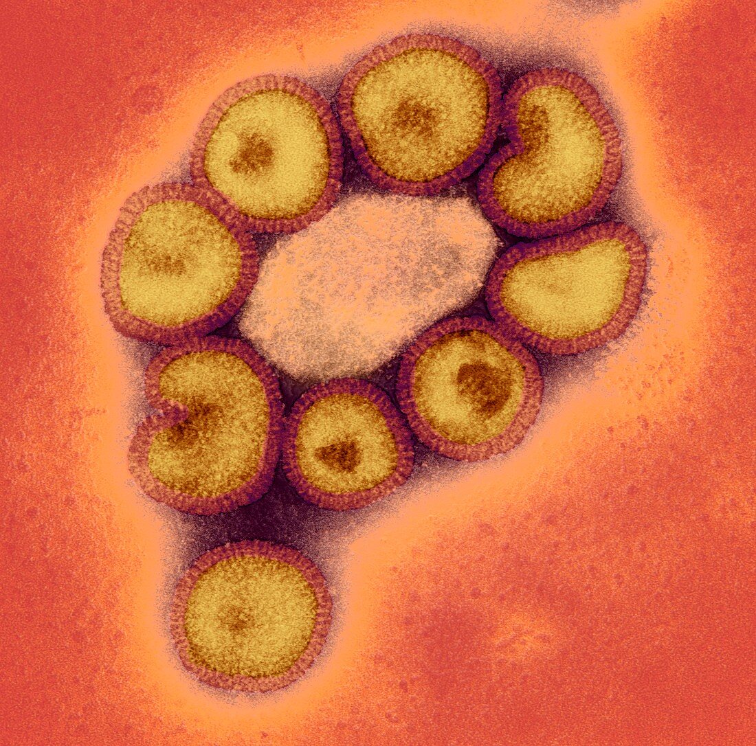 Swine flu virus particles,TEM
