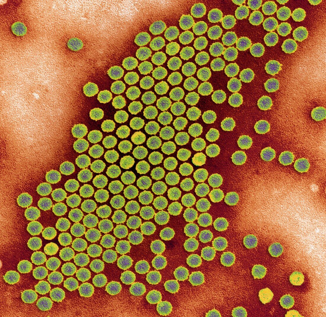 Polio virus particles,TEM