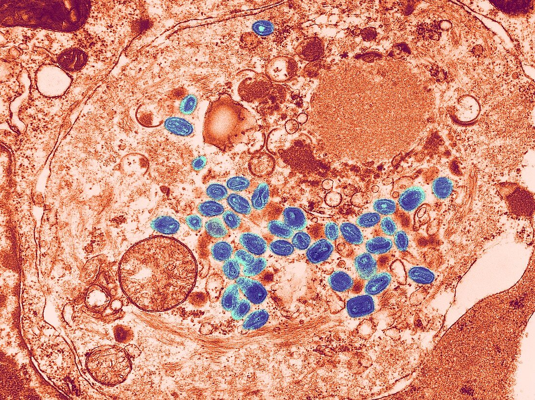 Smallpox virus particles,TEM