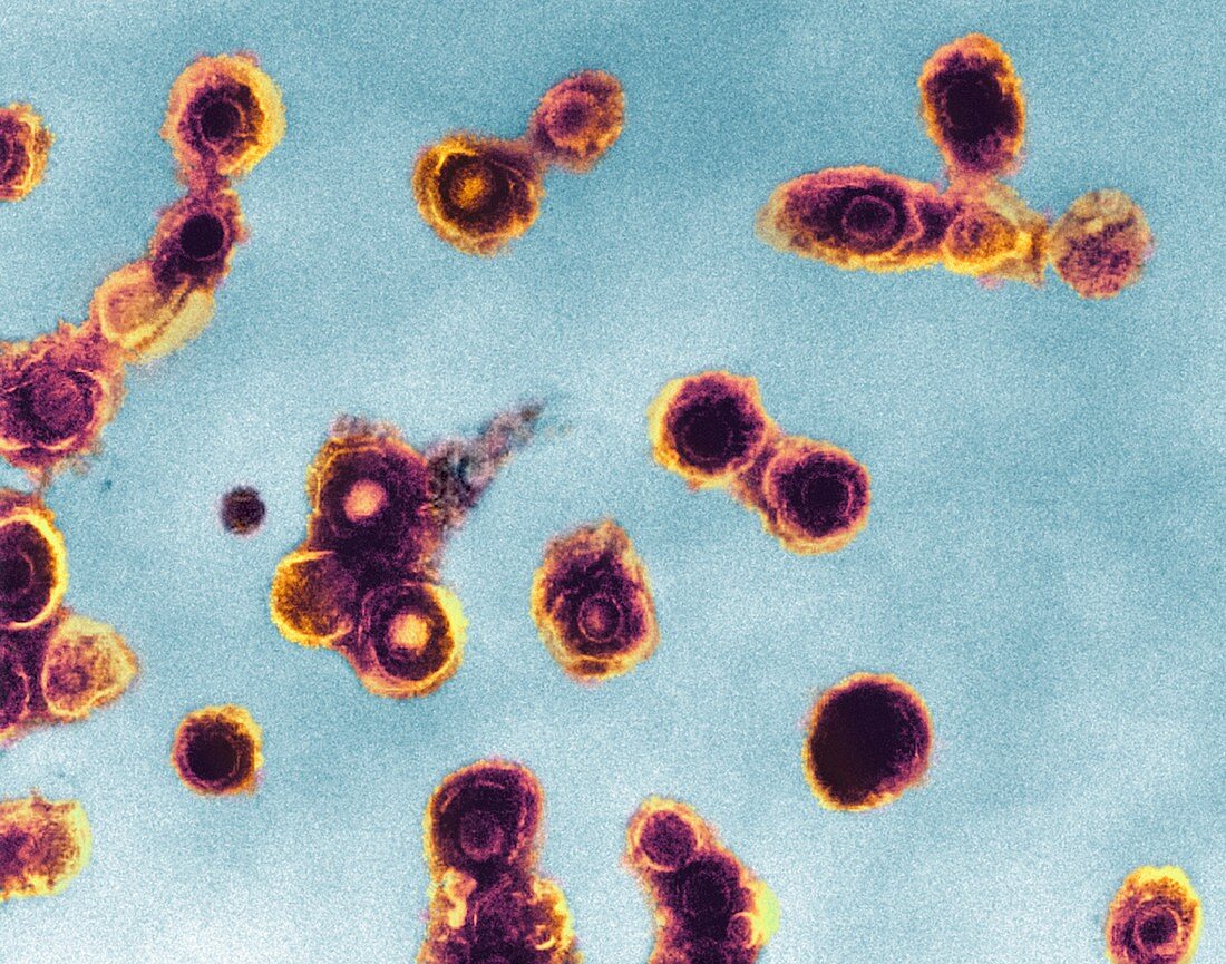 Varicella zoster virus particles,TEM