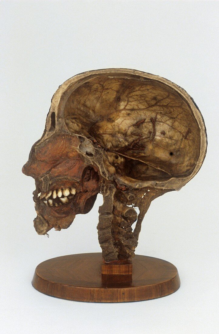 Sectional dissected head,19th century