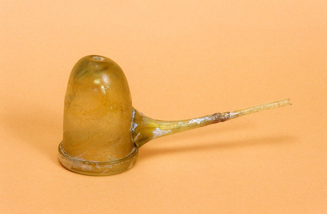 Crude cupping glass,17th century