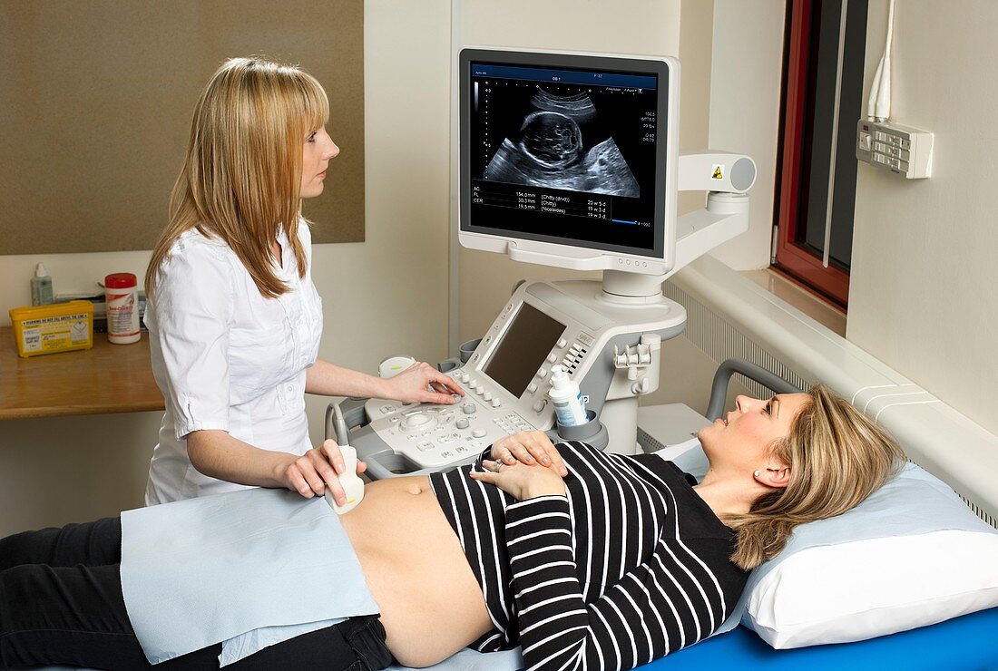 Ultrasound in pregnancy