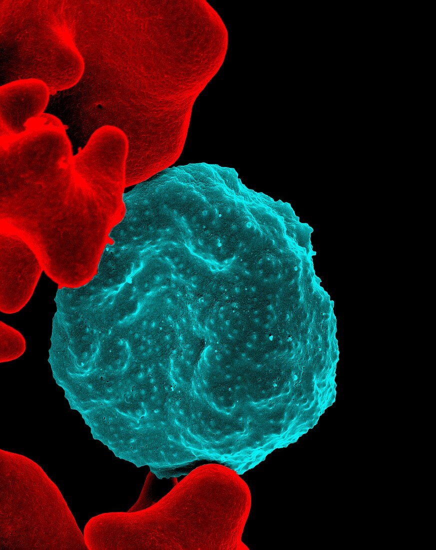 Malarial blood cell,SEM