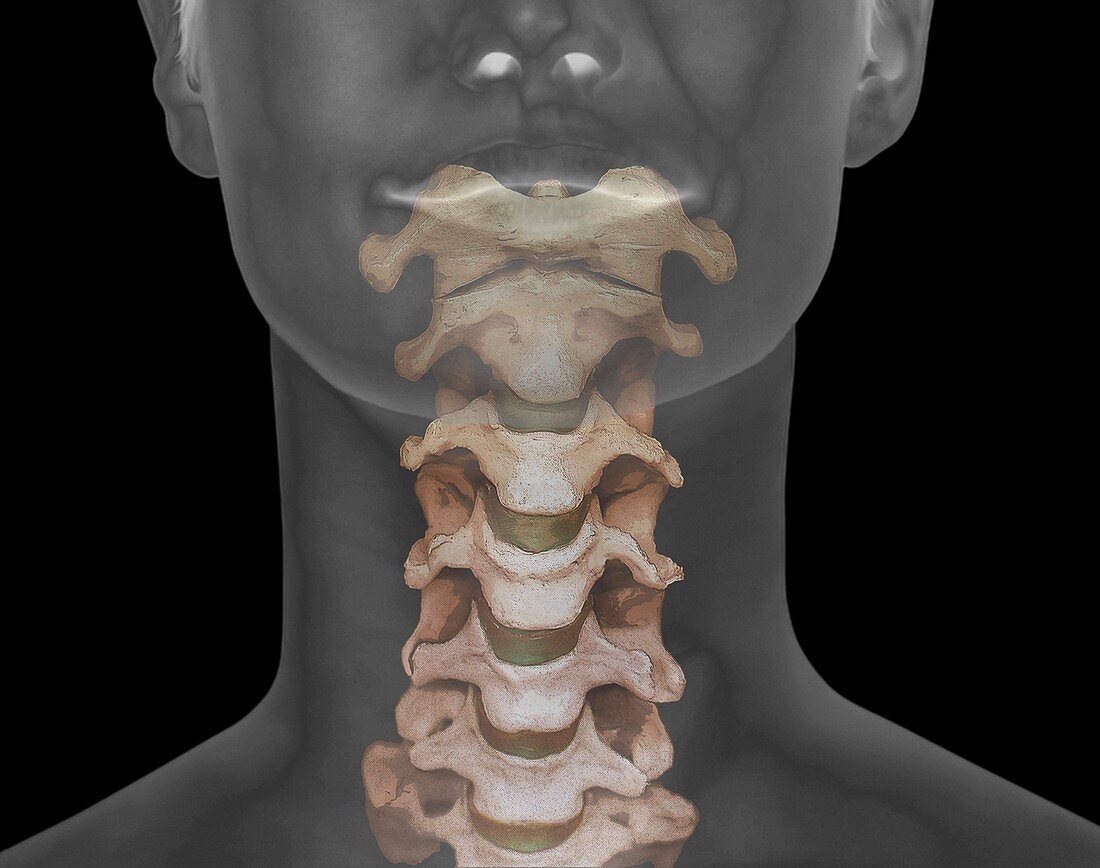 Healthy spine,CT scan
