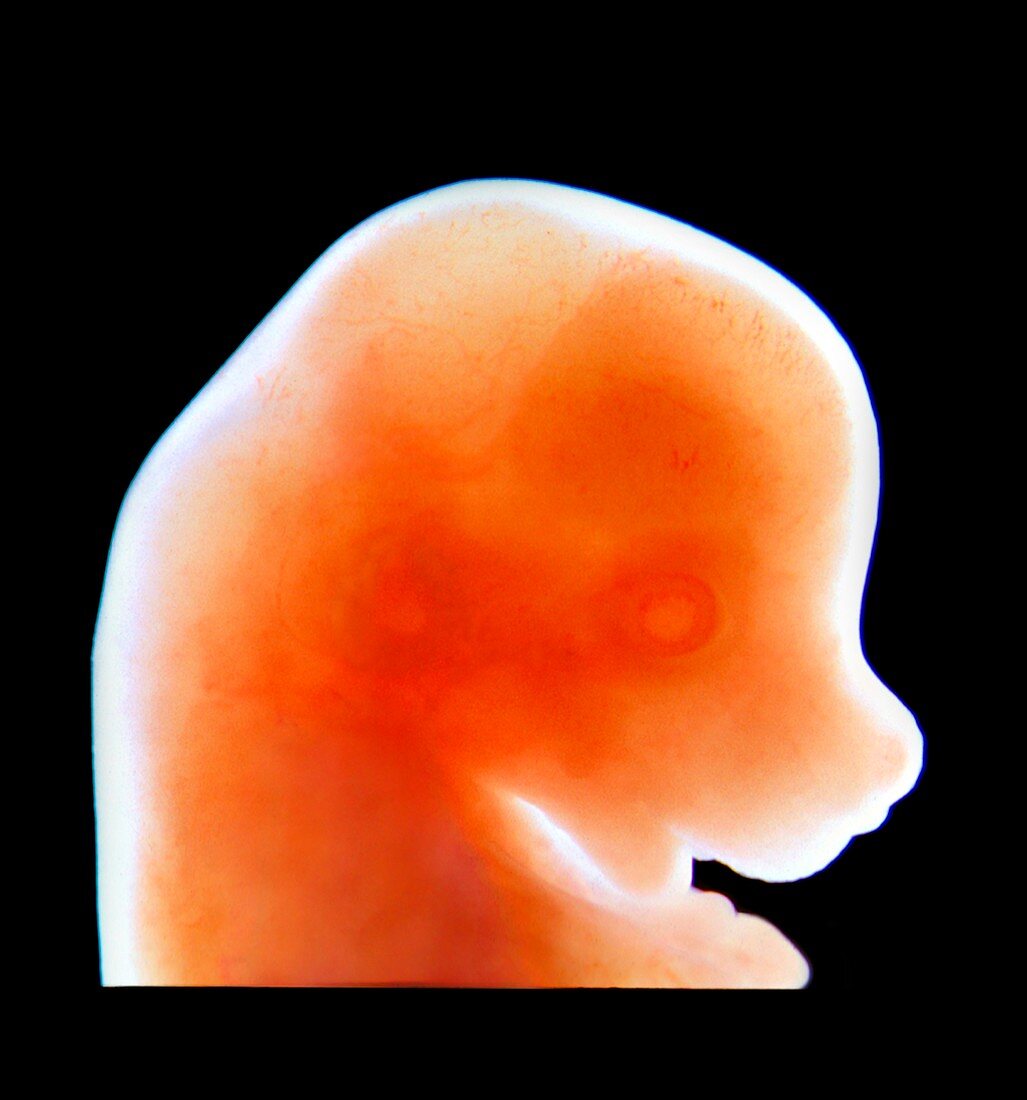 Mouse embryo,light micrograph
